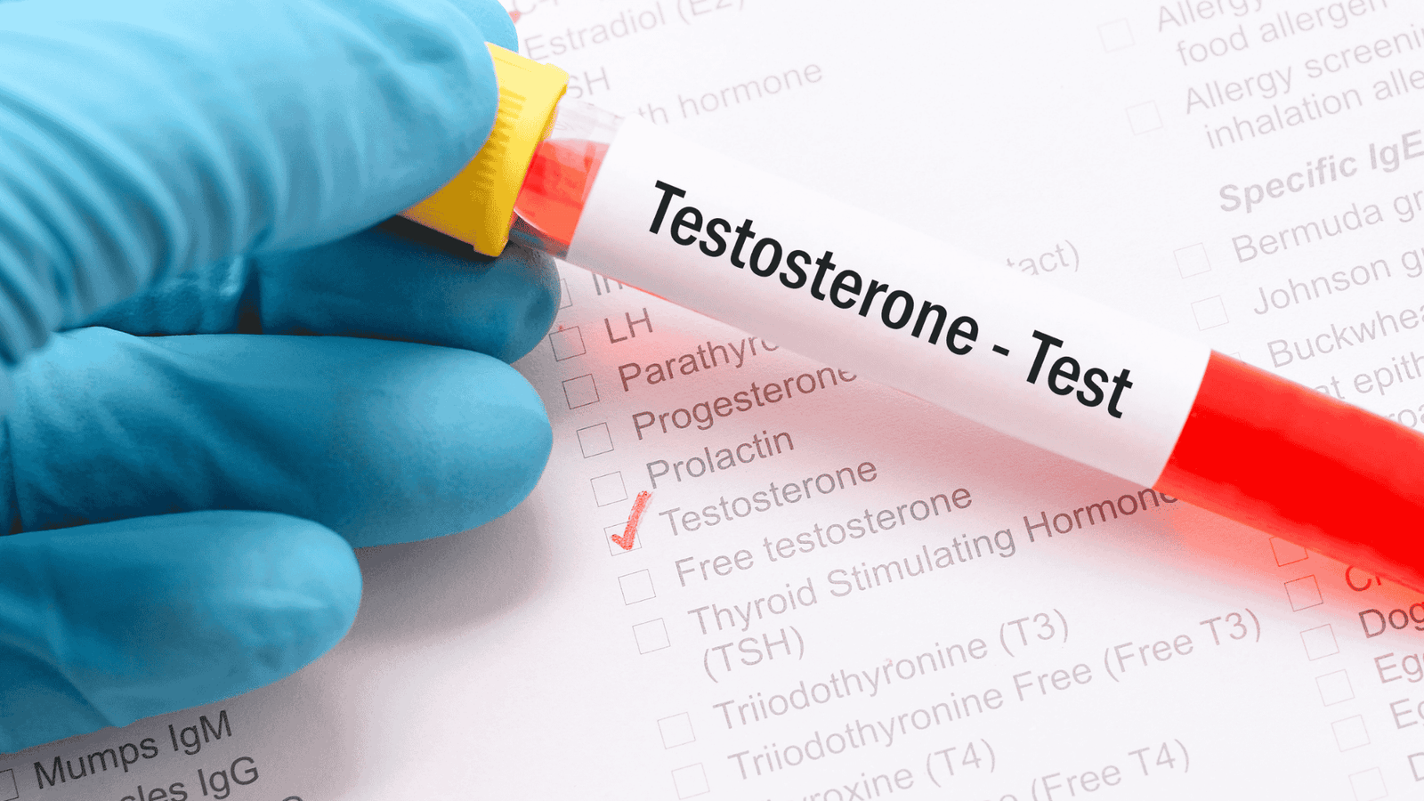 Terapia de Reposição de Testosterona (TRT) para Mulheres: Mitos, Verdades e o Equilíbrio Hormonal na Nutrologia